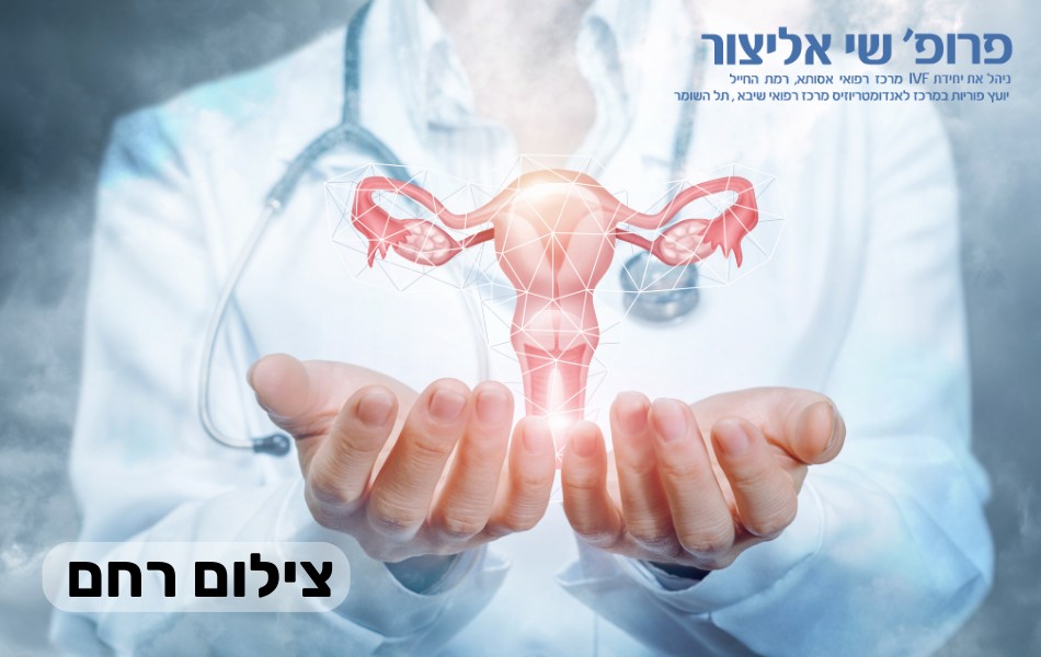 צילום רחם ללא כאב | בדיקת סונו היסטרוסלפינגוגרפיה - ד