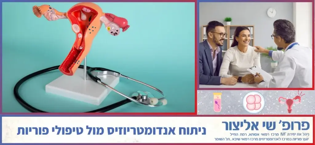 ניתוח אנדומטריוזיס מול טיפולי פוריות
